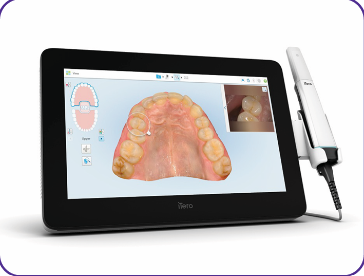 Scanner 3D